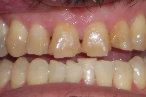 Frank Before